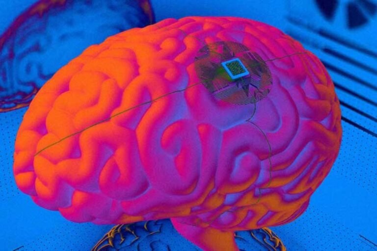 deep brain stimulation