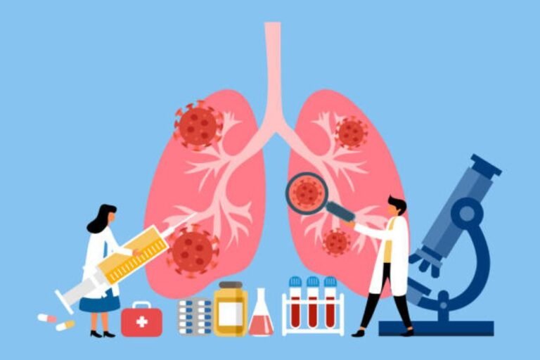 Lung Cancer