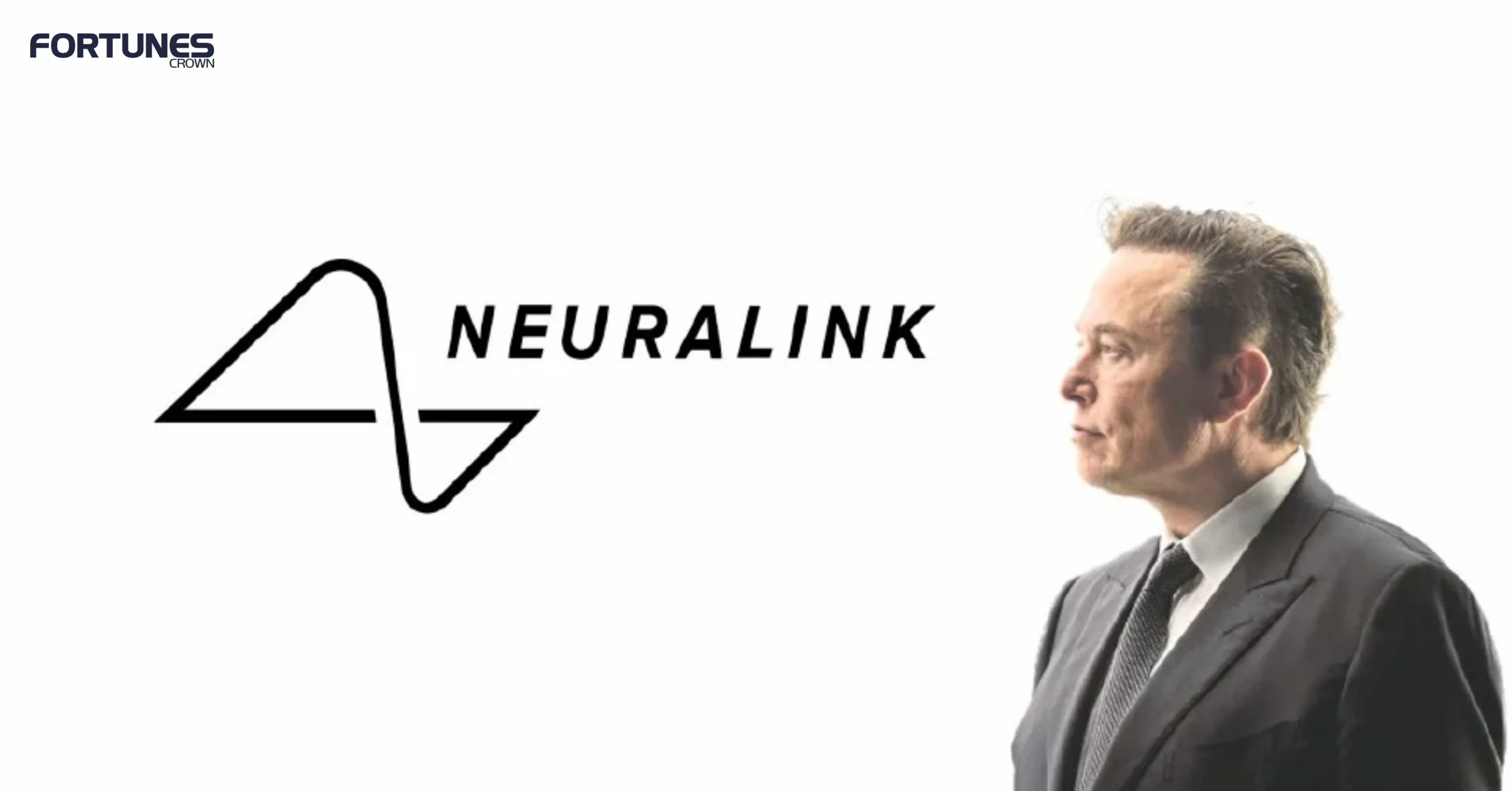 Elon Musk’s Neuralink To Start A 6-Year Human Trial Soon