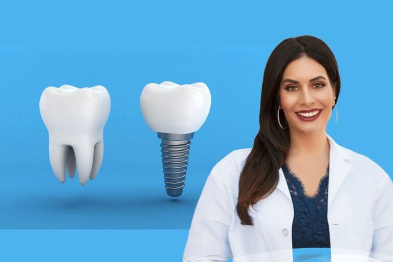 Dental Implants