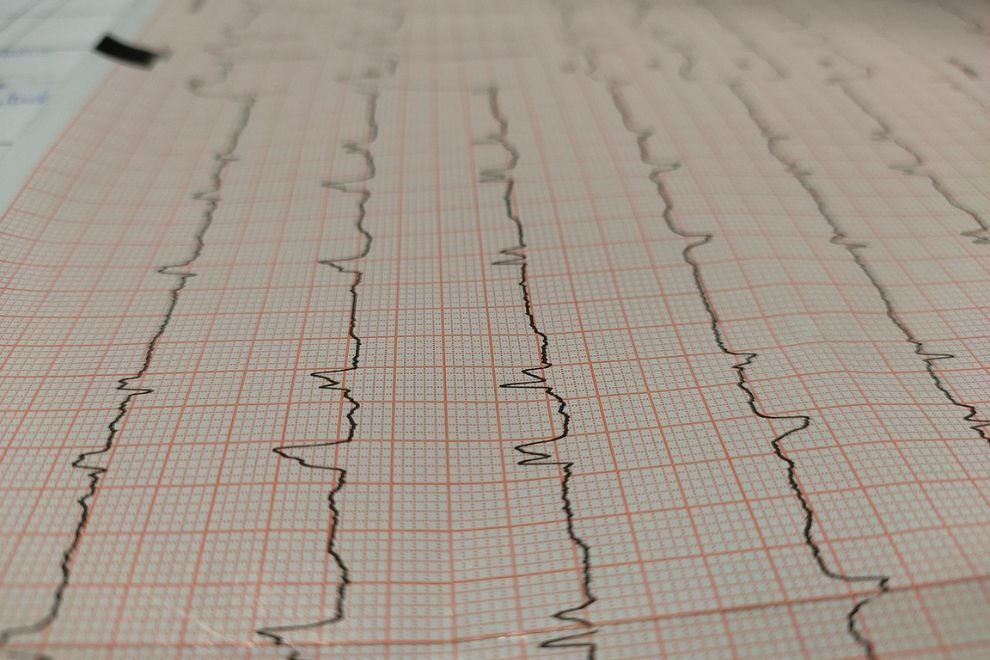 AI in Diagnostics: How Machine Learning is Reducing Medical Errors and Saving Lives